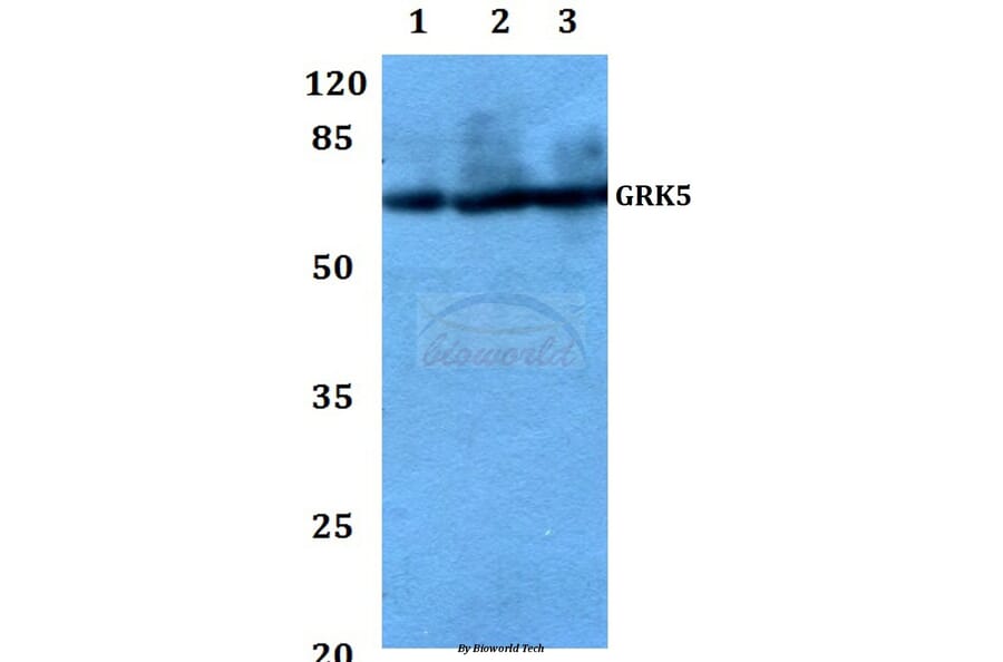 Anti-GRK5 (Q382) Antibody from Bioworld Technology (BS1981) - Antibodies.com