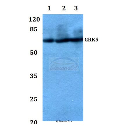 Anti-GRK5 (Q382) Antibody from Bioworld Technology (BS1981) - Antibodies.com