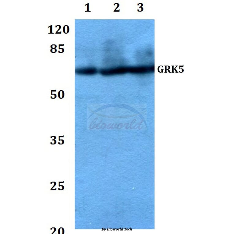 Anti-GRK5 (Q382) Antibody from Bioworld Technology (BS1981) - Antibodies.com