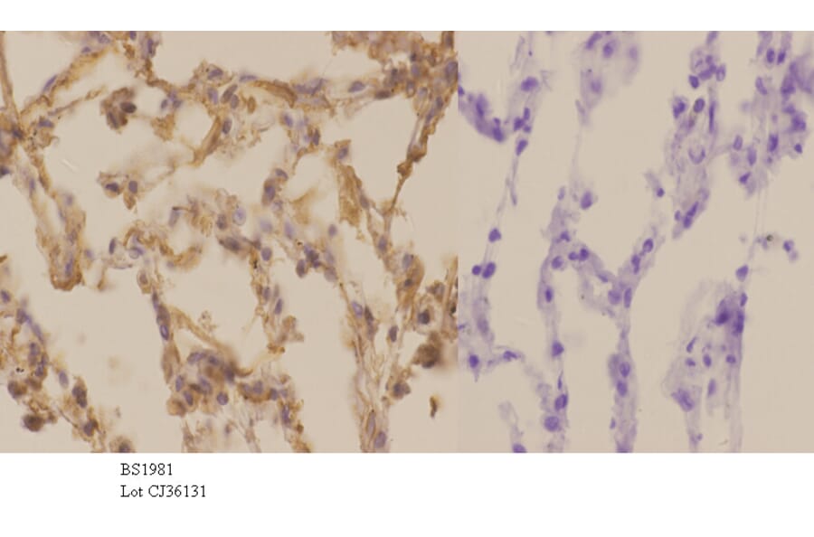 Anti-GRK5 (Q382) Antibody from Bioworld Technology (BS1981) - Antibodies.com