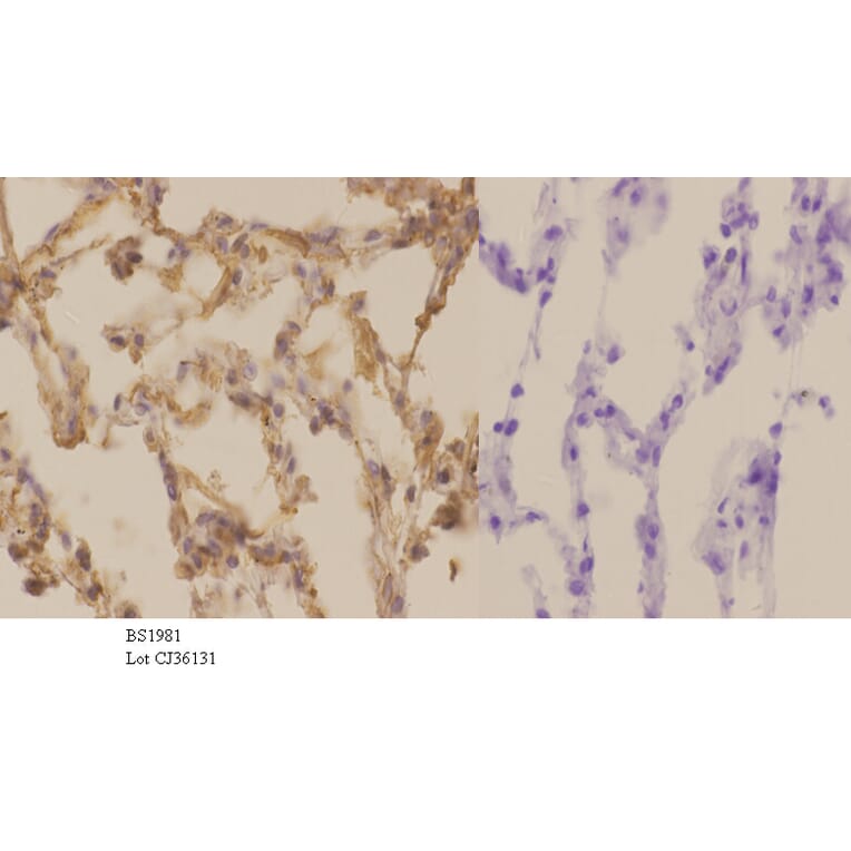 Anti-GRK5 (Q382) Antibody from Bioworld Technology (BS1981) - Antibodies.com