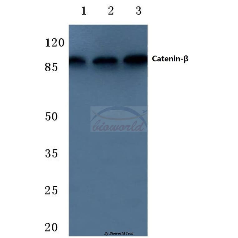 Anti-Catenin-β (F660) Antibody from Bioworld Technology (BS1982) - Antibodies.com