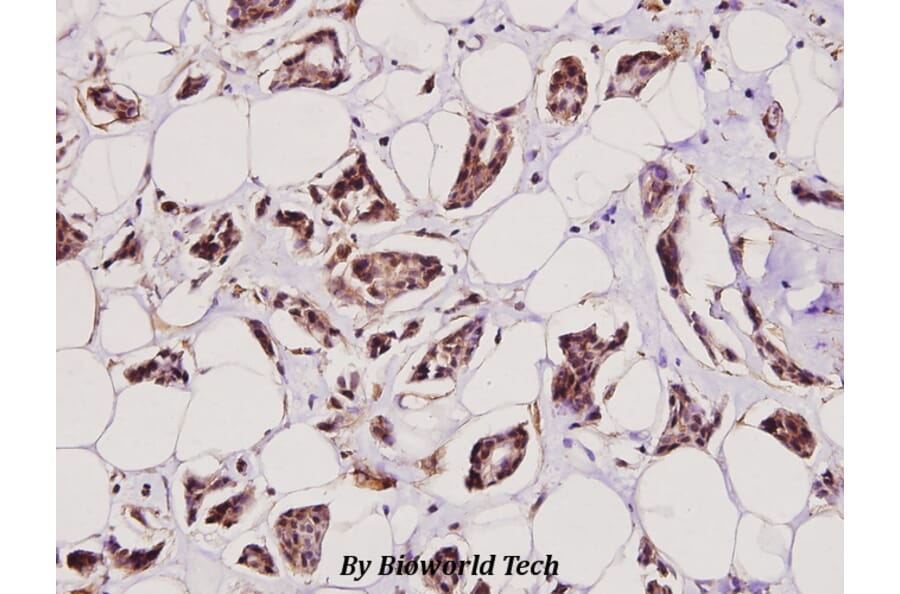 Anti-Catenin-β (F660) Antibody from Bioworld Technology (BS1982) - Antibodies.com