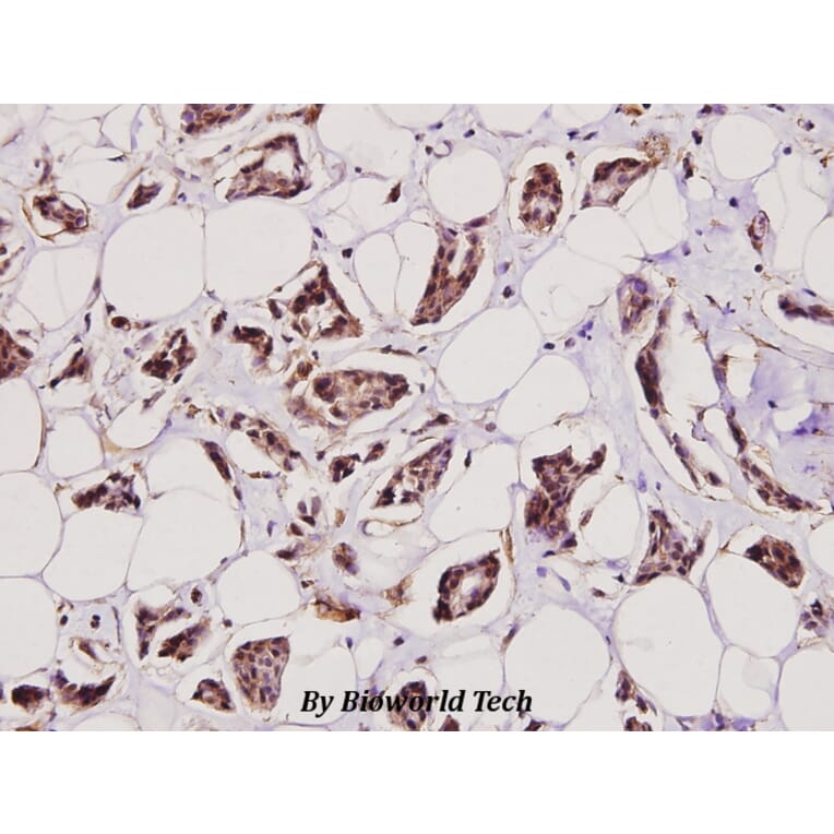 Anti-Catenin-β (F660) Antibody from Bioworld Technology (BS1982) - Antibodies.com