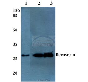 Anti-Recoverin (D143) Antibody from Bioworld Technology (BS1983) - Antibodies.com