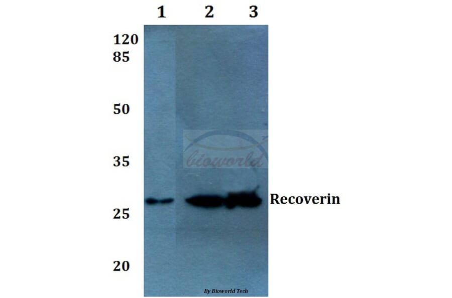Anti-Recoverin (D143) Antibody from Bioworld Technology (BS1983) - Antibodies.com