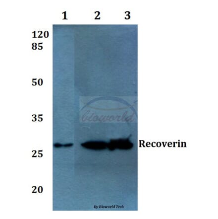 Anti-Recoverin (D143) Antibody from Bioworld Technology (BS1983) - Antibodies.com