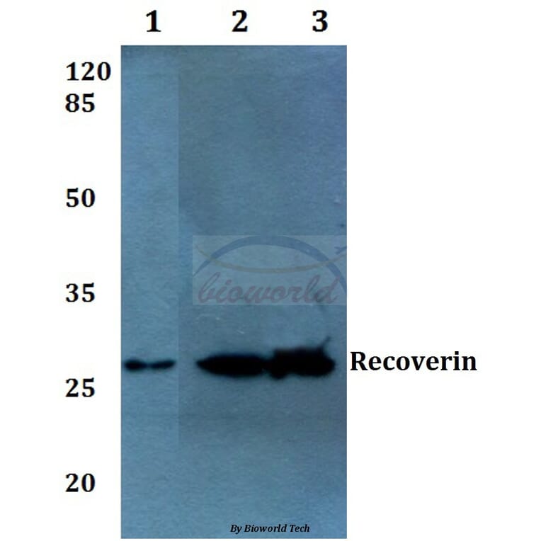Anti-Recoverin (D143) Antibody from Bioworld Technology (BS1983) - Antibodies.com