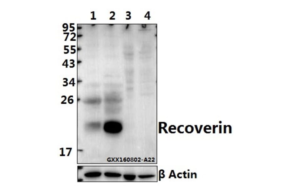 Anti-Recoverin (D143) Antibody from Bioworld Technology (BS1983) - Antibodies.com