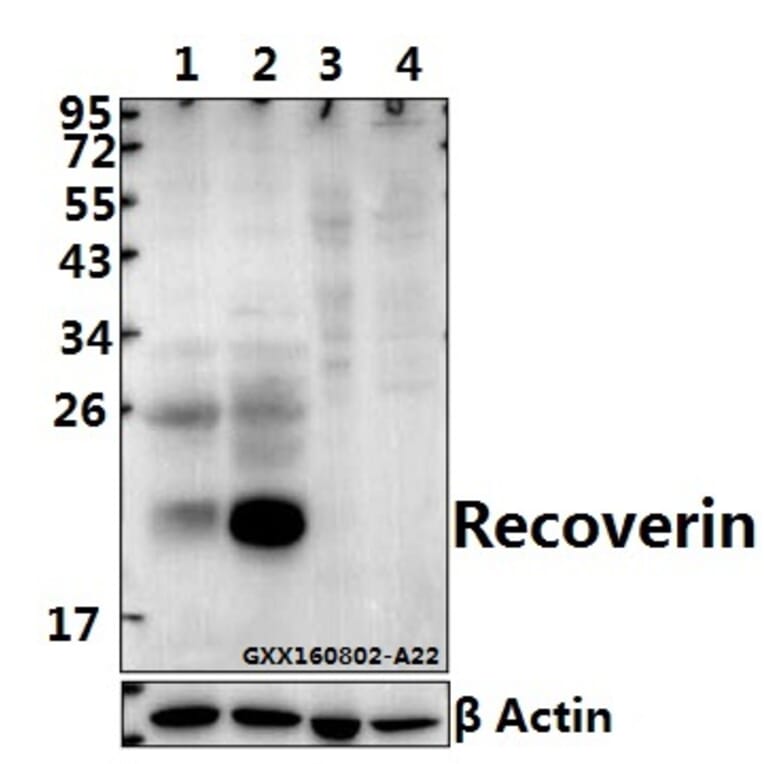 Anti-Recoverin (D143) Antibody from Bioworld Technology (BS1983) - Antibodies.com