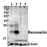 Anti-Recoverin (D143) Antibody from Bioworld Technology (BS1983) - Antibodies.com