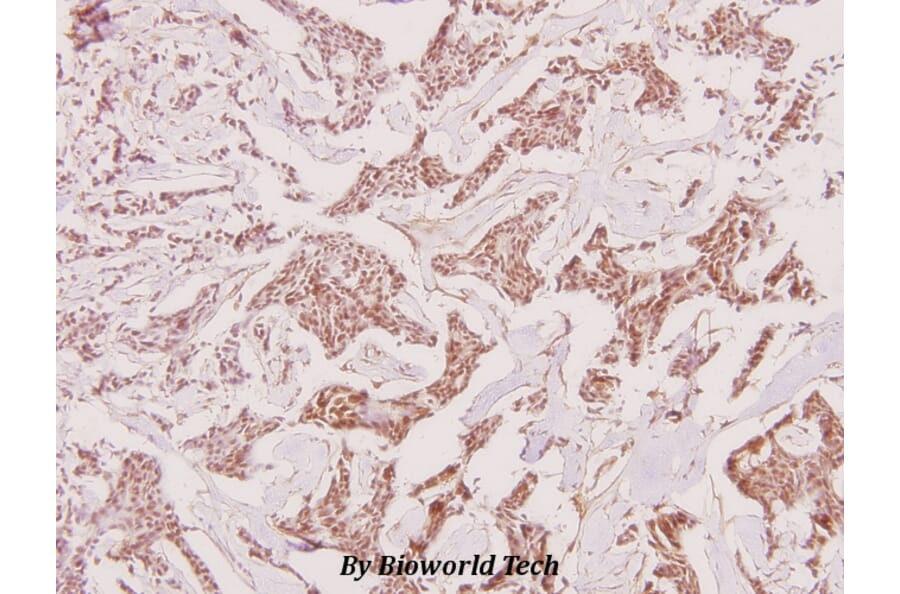 Anti-Recoverin (D143) Antibody from Bioworld Technology (BS1983) - Antibodies.com