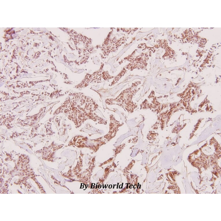 Anti-Recoverin (D143) Antibody from Bioworld Technology (BS1983) - Antibodies.com