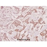 Anti-Recoverin (D143) Antibody from Bioworld Technology (BS1983) - Antibodies.com