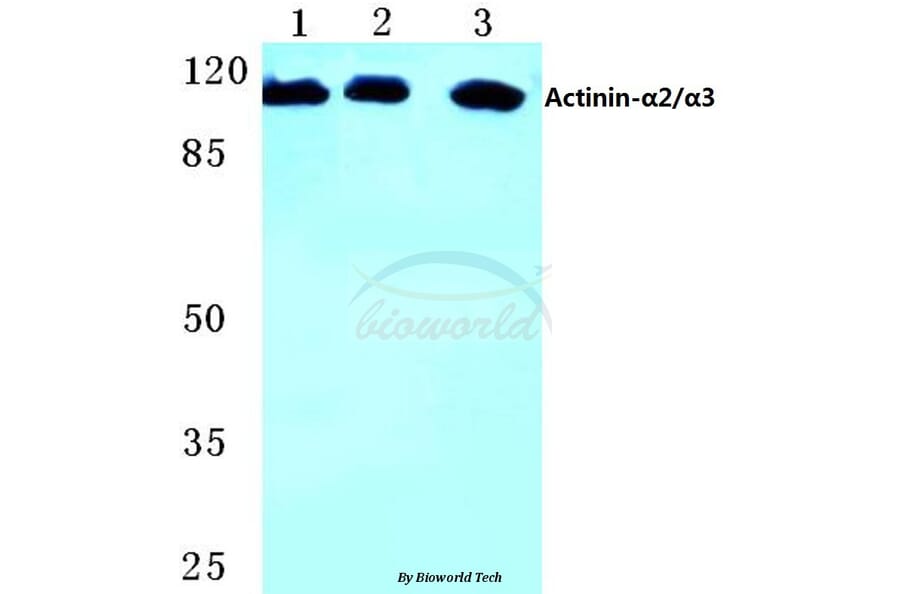 Anti-Actinin-α2/3 (Q58) Antibody from Bioworld Technology (BS1984) - Antibodies.com