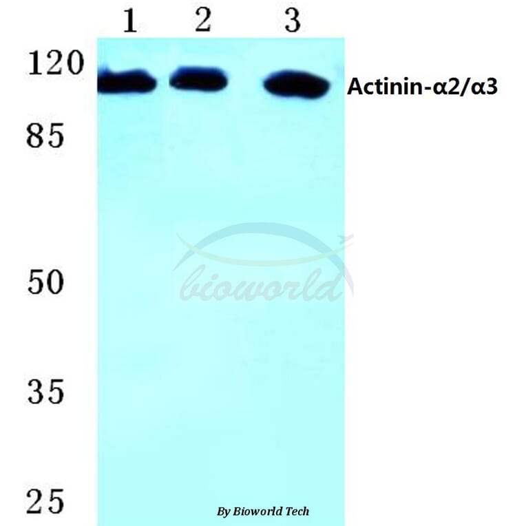 Anti-Actinin-α2/3 (Q58) Antibody from Bioworld Technology (BS1984) - Antibodies.com