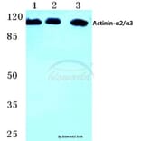 Anti-Actinin-α2/3 (Q58) Antibody from Bioworld Technology (BS1984) - Antibodies.com