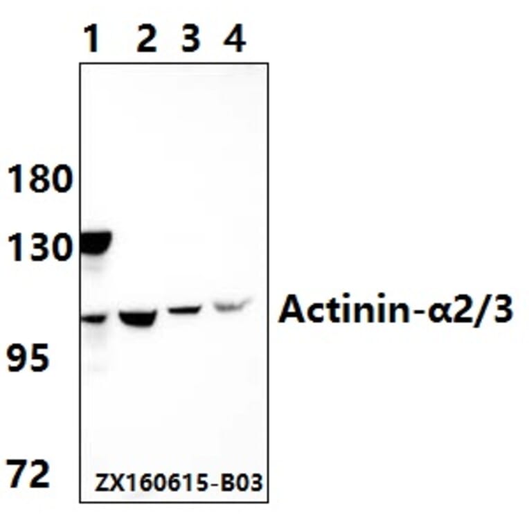 Anti-Actinin-α2/3 (Q58) Antibody from Bioworld Technology (BS1984) - Antibodies.com