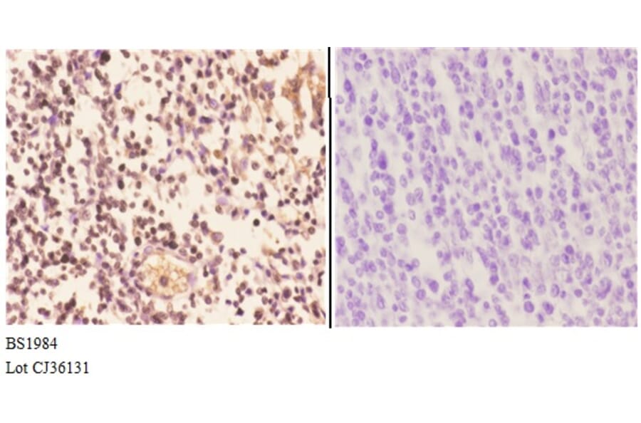 Anti-Actinin-α2/3 (Q58) Antibody from Bioworld Technology (BS1984) - Antibodies.com