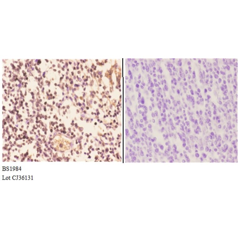 Anti-Actinin-α2/3 (Q58) Antibody from Bioworld Technology (BS1984) - Antibodies.com