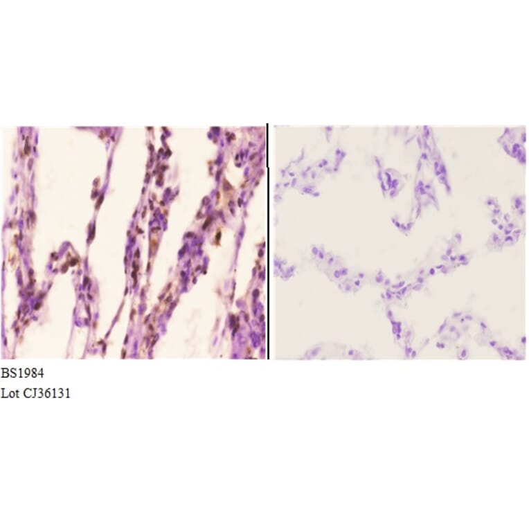 Anti-Actinin-α2/3 (Q58) Antibody from Bioworld Technology (BS1984) - Antibodies.com