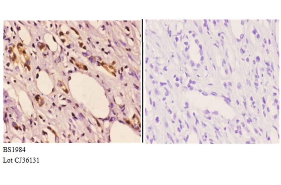 Anti-Actinin-α2/3 (Q58) Antibody from Bioworld Technology (BS1984) - Antibodies.com