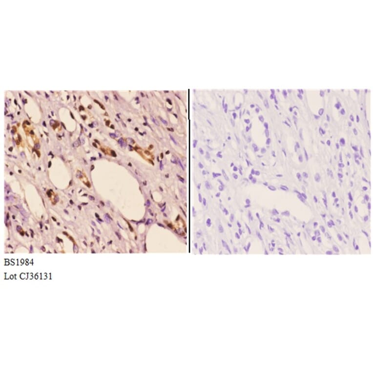 Anti-Actinin-α2/3 (Q58) Antibody from Bioworld Technology (BS1984) - Antibodies.com
