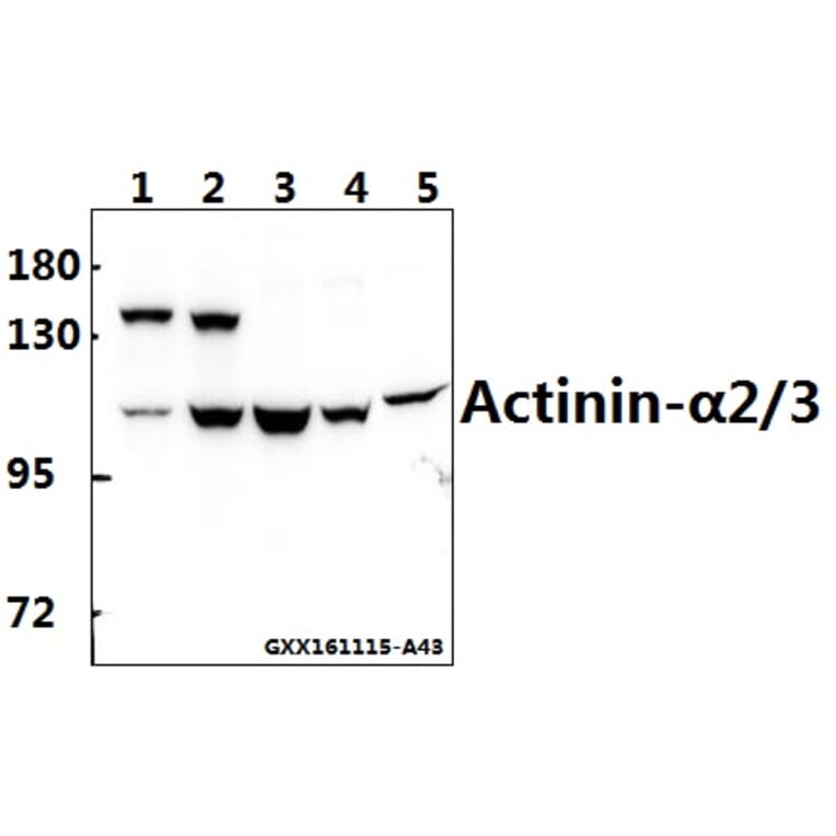 Anti-Actinin-α2/3 (Q58) Antibody from Bioworld Technology (BS1984) - Antibodies.com