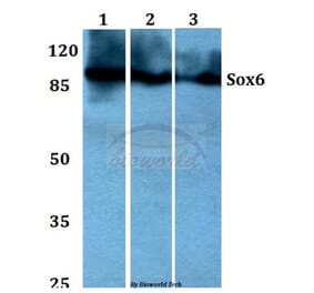 Anti-Sox6 (D23) Antibody from Bioworld Technology (BS1986) - Antibodies.com