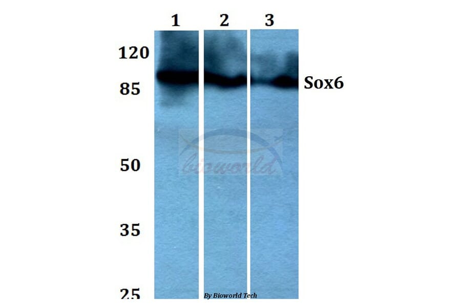 Anti-Sox6 (D23) Antibody from Bioworld Technology (BS1986) - Antibodies.com