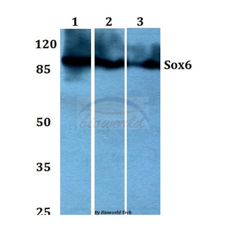 Anti-Sox6 (D23) Antibody from Bioworld Technology (BS1986) - Antibodies.com
