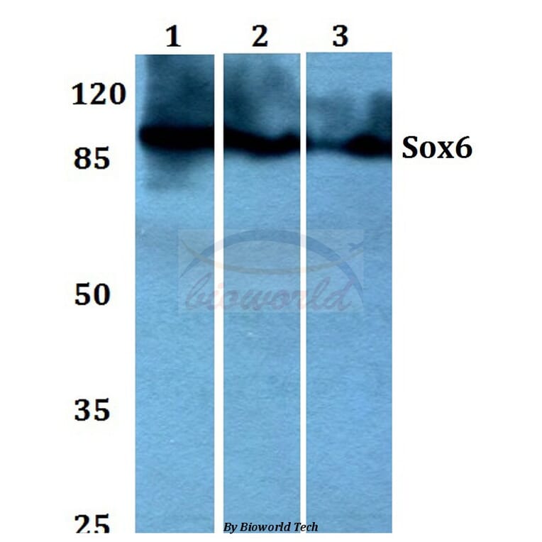 Anti-Sox6 (D23) Antibody from Bioworld Technology (BS1986) - Antibodies.com