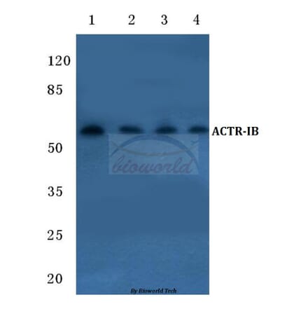 Anti-ACTR-IB (G111) Antibody from Bioworld Technology (BS1988) - Antibodies.com