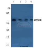 Anti-ACTR-IB (G111) Antibody from Bioworld Technology (BS1988) - Antibodies.com