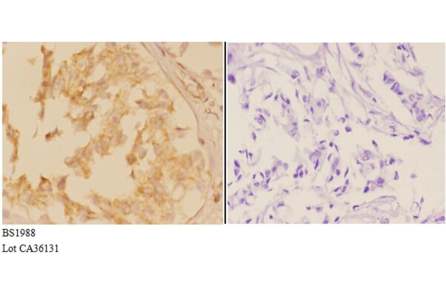 Anti-ACTR-IB (G111) Antibody from Bioworld Technology (BS1988) - Antibodies.com
