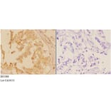 Anti-ACTR-IB (G111) Antibody from Bioworld Technology (BS1988) - Antibodies.com