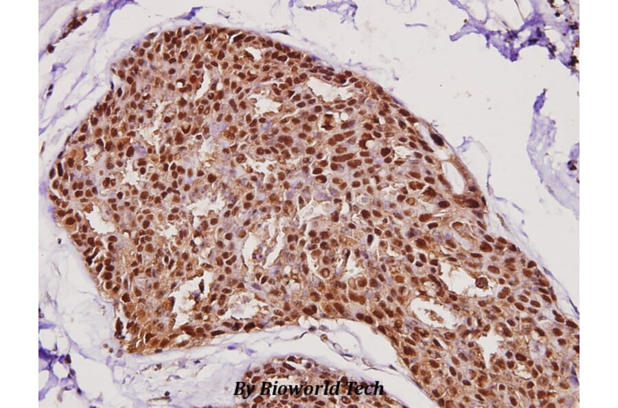 Anti-FEN1 (A119) Antibody from Bioworld Technology (BS1989) - Antibodies.com