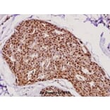 Anti-FEN1 (A119) Antibody from Bioworld Technology (BS1989) - Antibodies.com