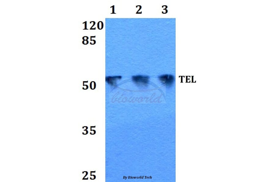 Anti-TEL (N405) Antibody from Bioworld Technology (BS1990) - Antibodies.com