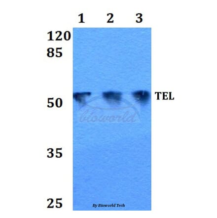 Anti-TEL (N405) Antibody from Bioworld Technology (BS1990) - Antibodies.com