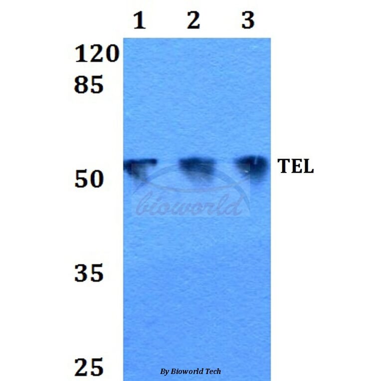 Anti-TEL (N405) Antibody from Bioworld Technology (BS1990) - Antibodies.com
