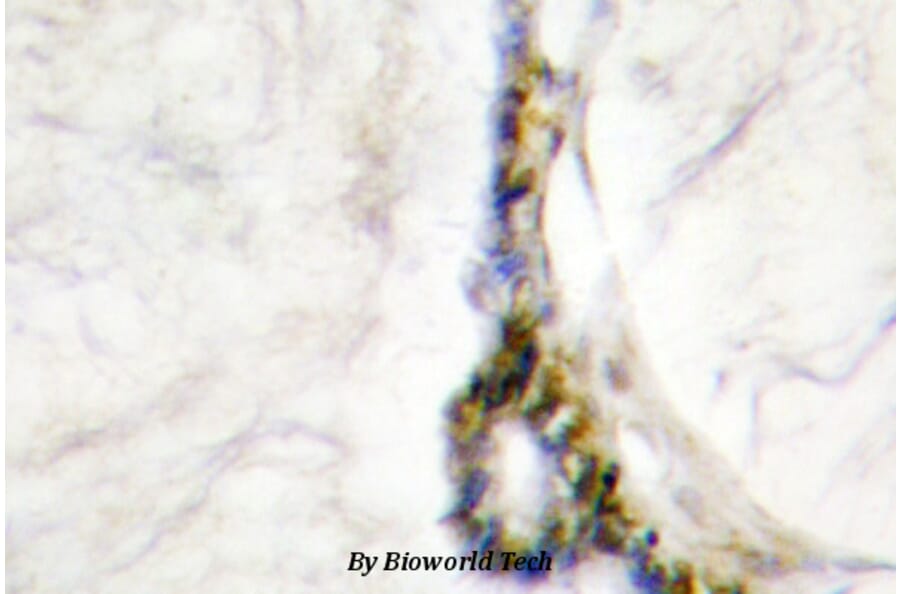 Anti-HNF4α/γ (K127) Antibody from Bioworld Technology (BS1992) - Antibodies.com