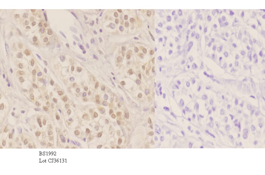 Anti-HNF4α/γ (K127) Antibody from Bioworld Technology (BS1992) - Antibodies.com