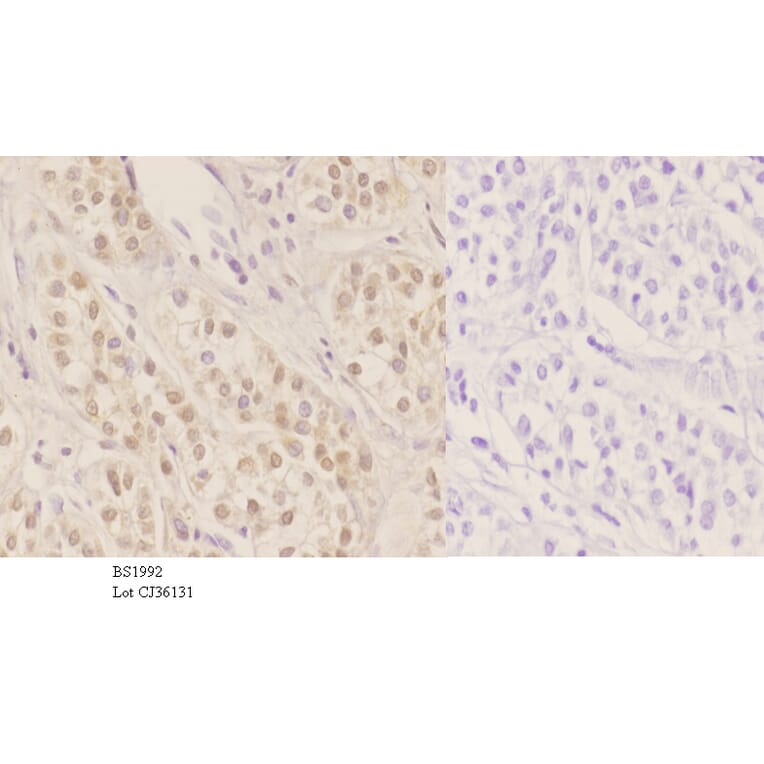 Anti-HNF4α/γ (K127) Antibody from Bioworld Technology (BS1992) - Antibodies.com