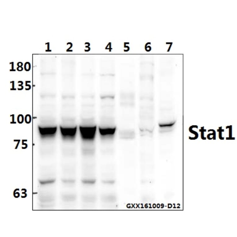Anti-Stat1 (L177) Antibody from Bioworld Technology (BS1994) - Antibodies.com