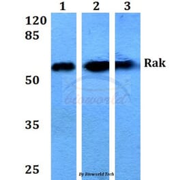 Anti-Rak (N103) Antibody from Bioworld Technology (BS1996) - Antibodies.com
