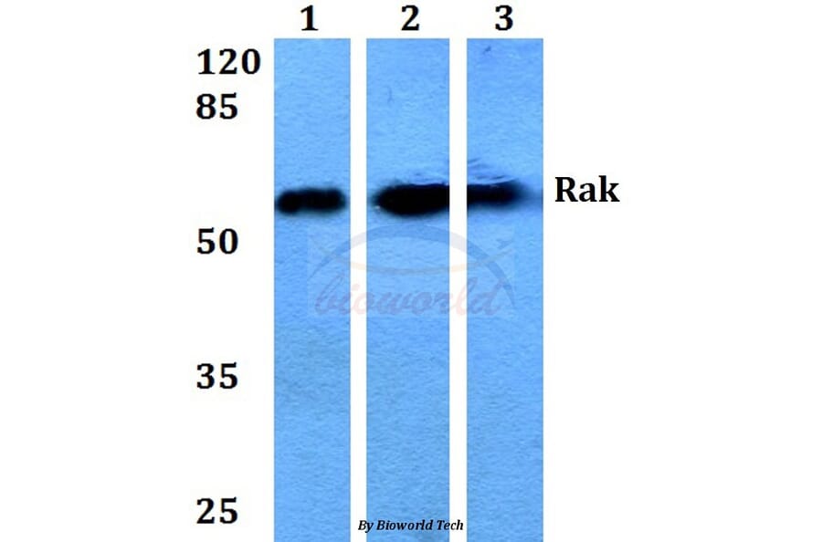 Anti-Rak (N103) Antibody from Bioworld Technology (BS1996) - Antibodies.com