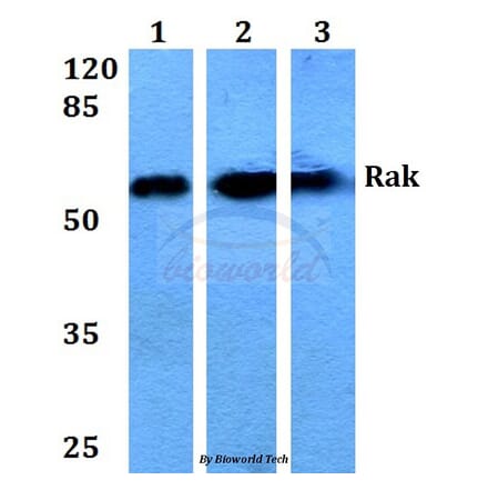 Anti-Rak (N103) Antibody from Bioworld Technology (BS1996) - Antibodies.com