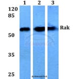 Anti-Rak (N103) Antibody from Bioworld Technology (BS1996) - Antibodies.com