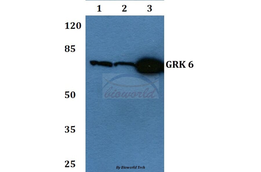 Anti-GRK 6 (N22) Antibody from Bioworld Technology (BS1997) - Antibodies.com